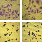 Synthesis and characterization of novel biodegradable and biocompatible poly(ester-urethane) thin films prepared by homogeneous solution polymerization. 